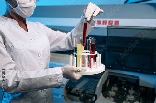 Close up  Woman holds a set of test tubes with various liquids in a modern laboratory. Fluid analysis  scientific research. Medicine and healthcare.