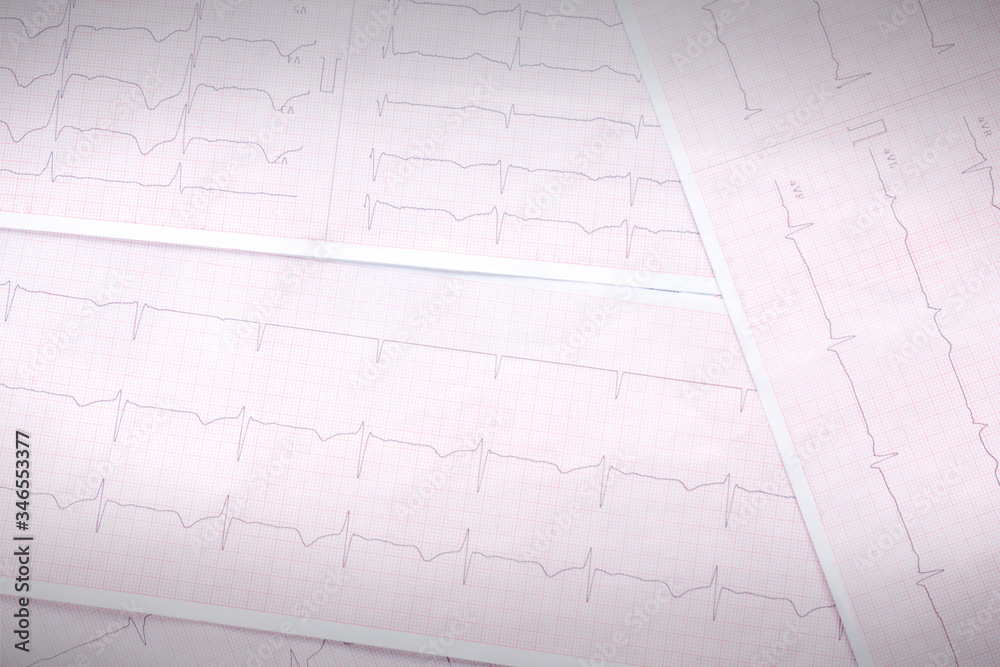 shetts of cardiogram lay on table medicine concept. place for text shetts of cardiogram lay on table medicine concept. place for text