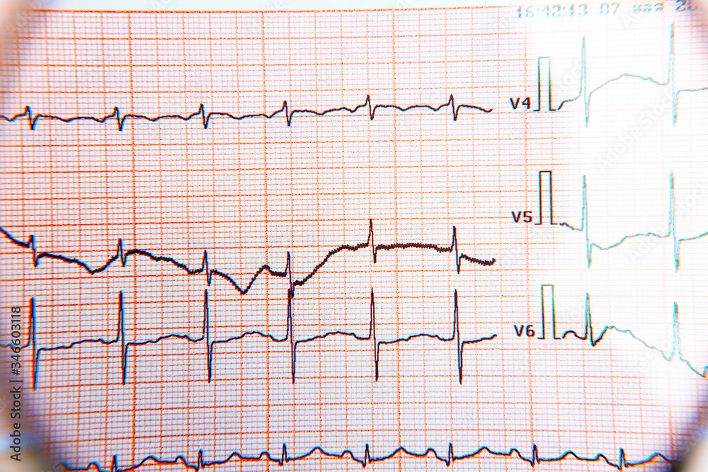 Cardiogram view through a magnifier, top view
