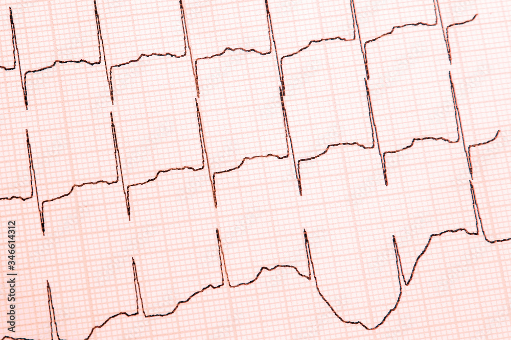 Cardiogram close-up, top view
