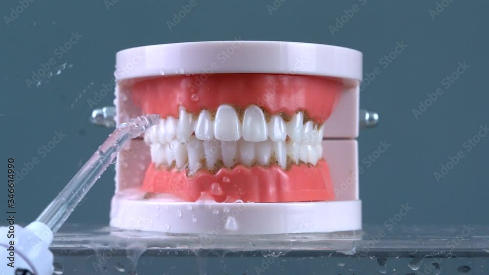 Tooth jaw. Brushing teeth with a dental irrigator. Brushing teeth