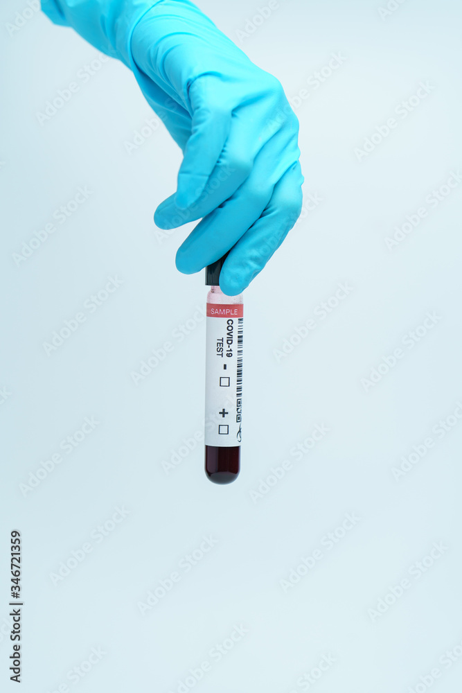 Obraz premium Hand with blue glove holding blood test tube samples of coronavirus (COVID-19).