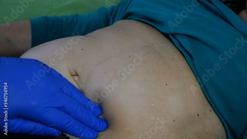 Doctor palpates with hand in blue rubber glove stomach of sick woman who is lying in bed. Close-up.