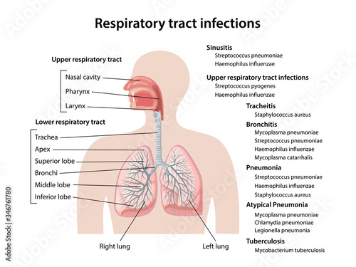 Human respiratory system with description of the corresponding parts. Respiratory tract infections of upper and lower respiratory tracts. Anatomical vector illustration in flat style.