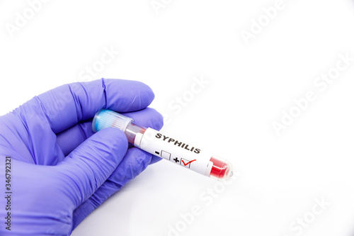 Closeup of microbiologist or medical worker hand with blue surgical gloves marking blood test result as positive for the syphilis. Syphilis Positive concept photo