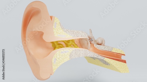 3d render ear cleansing ear stick. cleansing earwax with an ear stick