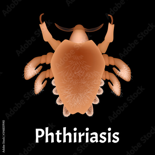 Parasitic diseases of Phthiriasis. Pediculosis pubis. Pubic lice structure. Sexually transmitted diseases. Infographics. Vector illustration on isolated background.