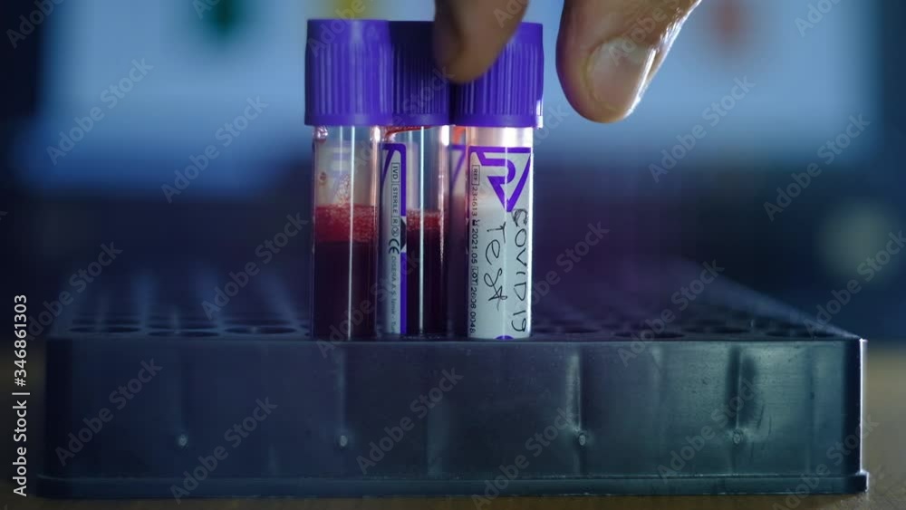 medical test tubes with blood of patients