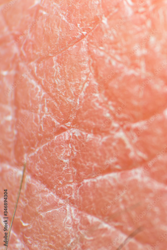 macro photo of dry human skin after frequent washing hands with soap macro photo of dry human skin after frequent washing hands with soap