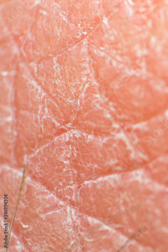 macro photo of dry human skin after frequent washing hands with soap