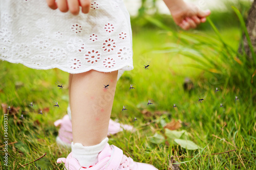 cute asian little girl has skin rash and allergy from mosquito bite and sucking blood at legs while playing on green grass field outdoor