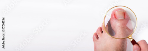 Person Holding Magnifying Glass Over Sore Toe Nail