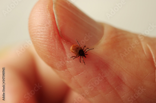 A parasitic tick on a person’s finger