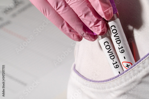 A doctor in pink gloves puts two test tubes in a pocket of a dressing gown with a positive test for COVID-19 virus © Дмитрий Цыбенко