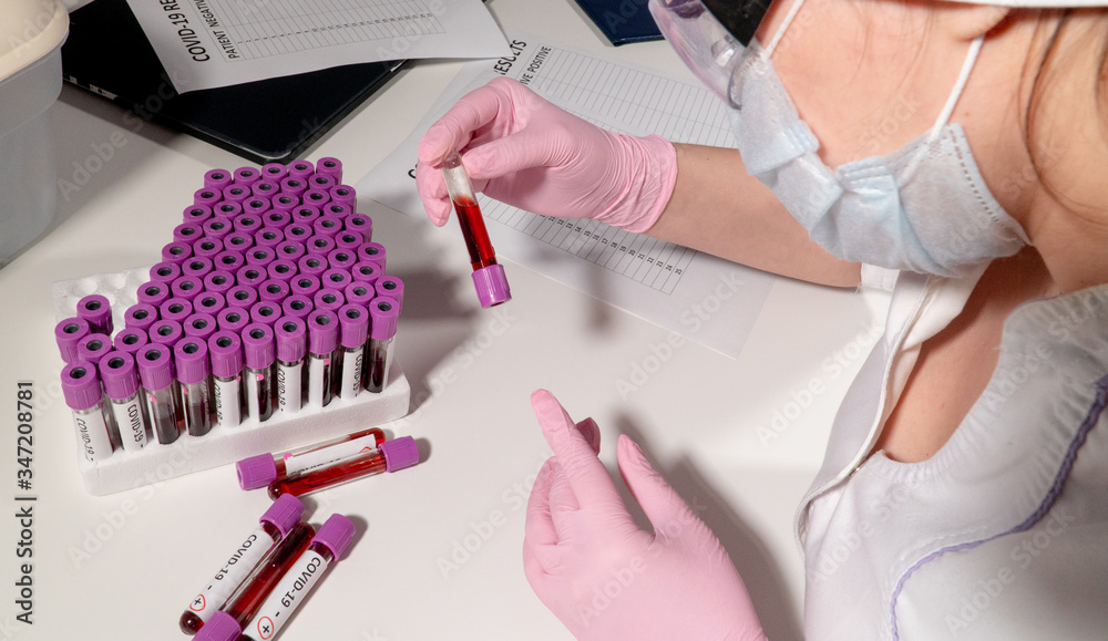 Fototapeta premium The doctor is holding a test tube with the analysis of CHOVID-19 next to a large assay with blood on the table in the hospital