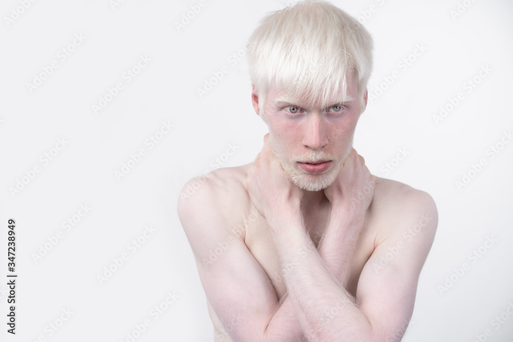 portrait of an albino man in studio dressed t-shirt isolated on a white background. abnormal deviations. unusual appearance portrait of an albino man in studio dressed t-shirt isolated on a white background. abnormal deviations. unusual appearance