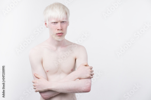 portrait of an albino man in  studio dressed t-shirt isolated on a white background. abnormal deviations. unusual appearance photo