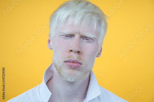 portrait of an albino man in studio dressed t-shirt isolated on a yellow background. abnormal deviations. unusual appearance