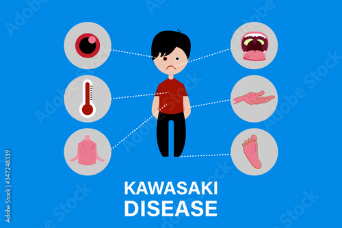 Kawasaki disease symptoms
