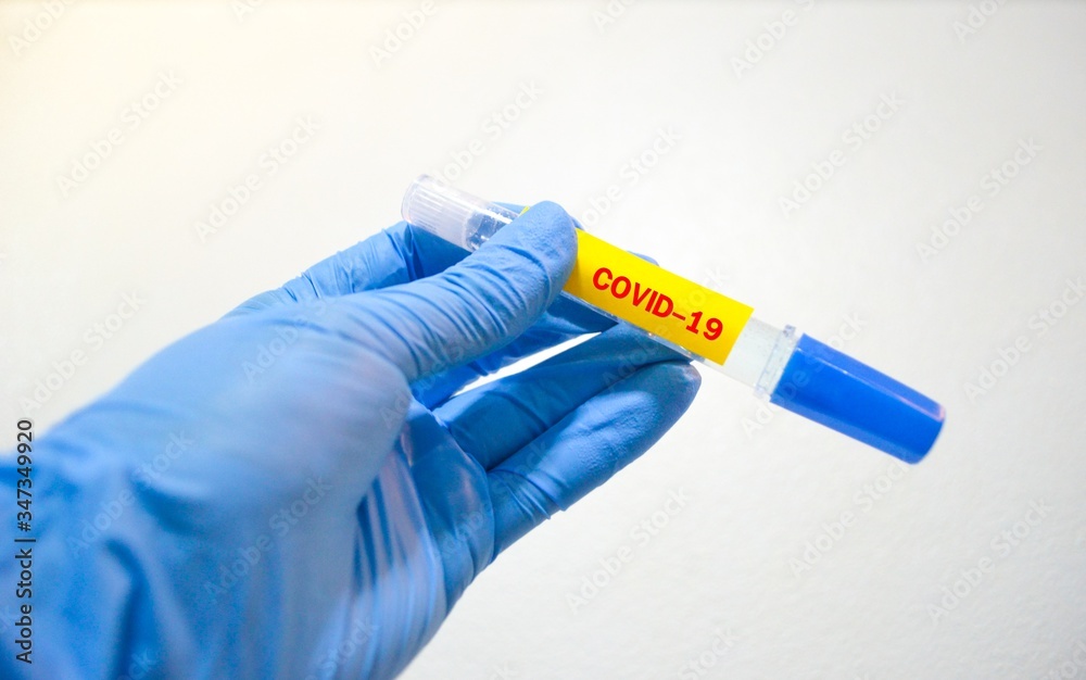 Hand wearing blue rubber nitride glove holding a tube of test result for the new rapidly spreading Coronavirus.Test tube with covid-19 word. Hand wearing blue rubber nitride glove holding a tube of test result for the new rapidly spreading Coronavirus.Test tube with covid-19 word.