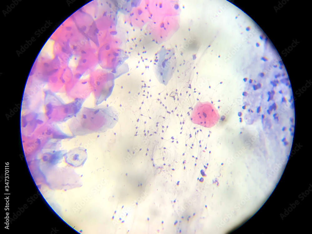 Microscopic image of cytological examination of the female genital ...