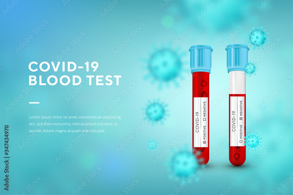 Laboratory blood test for virus Covid19. Set Realistic 3d glass test tube. Corona virus infection, novel coronavirus disease 2019. Concept marketing for banner and website, landing page template.
