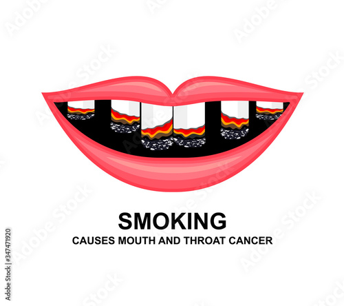 Cigarette in human mouth. Smoking causes damage to the teeth. World no tobacco day. Vector illustration isolated on white background.