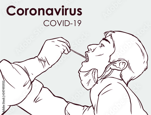  Vector illustration of doctor carrying out a swab on a patient. Covid-19. 