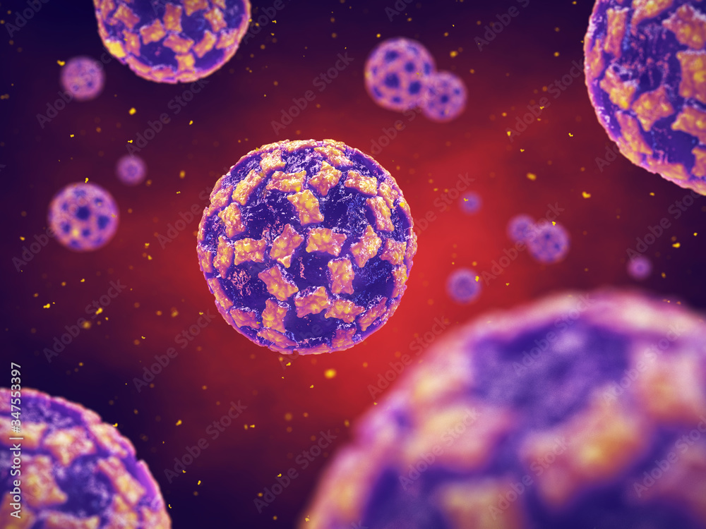 Norovirus also known as the vomiting bug is the cause of viral