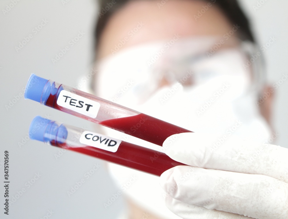 Laboratory assistant holding test tube of covid-19 virus Laboratory assistant holding test tube of covid-19 virus