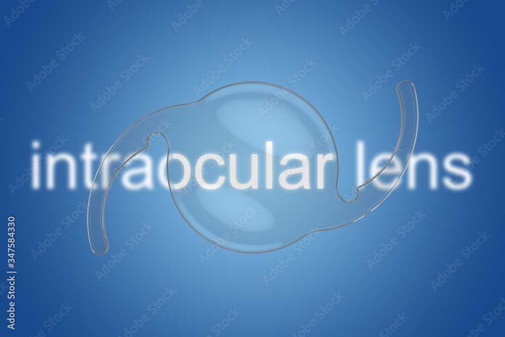 intraocular lens iol cataract ophthalmology intraocular lens iol cataract ophthalmology