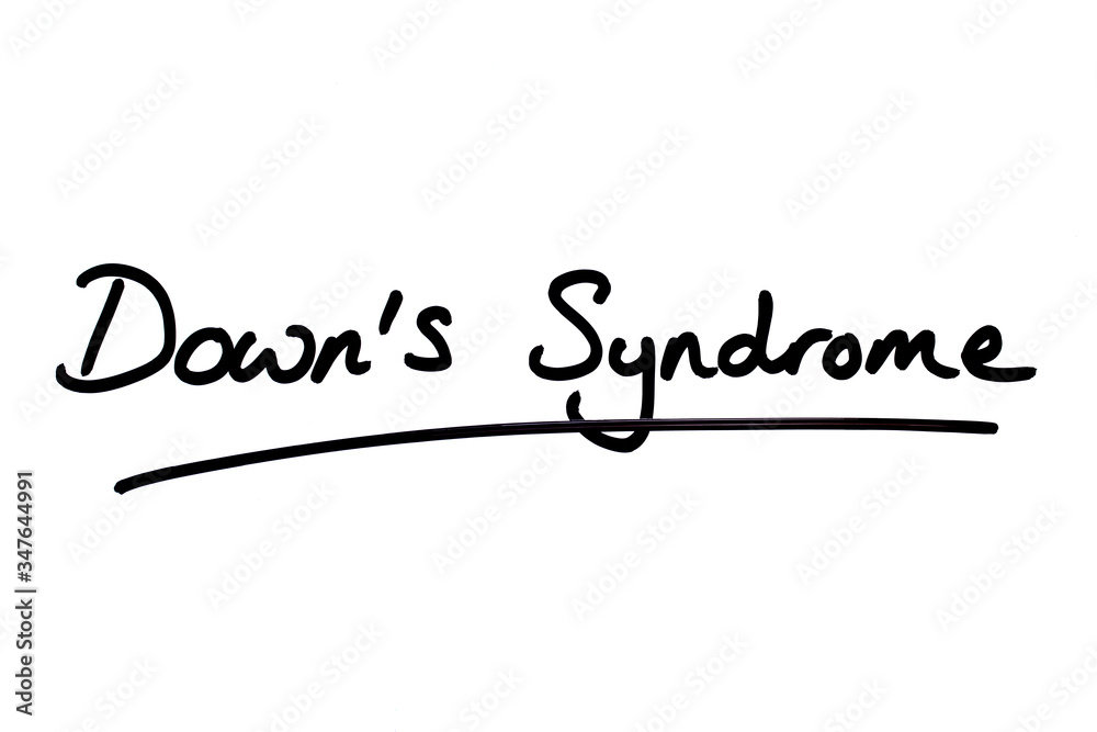 Downs Syndrome Downs Syndrome