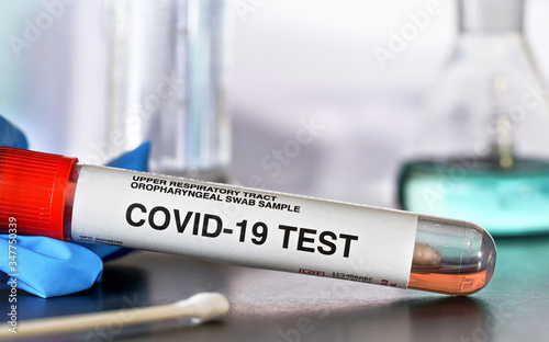 Coronavirus test concept - vial sample tube with cotton swab, blue gloves near, blurred lab glass background, closeup detail. (Sticker is own design with dummy data, not real product)