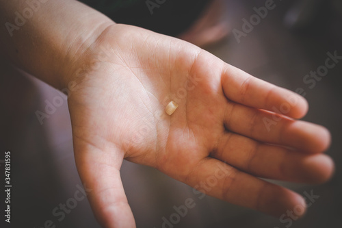 Close up image of a young girl loosing a tooth