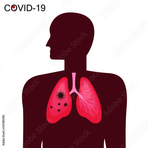 Coronavirus in the lungs. Covid-19, vector, illustration