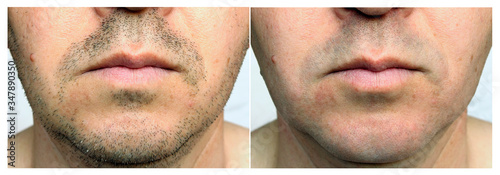 Foto A set of two photographs of men before and after shaving
