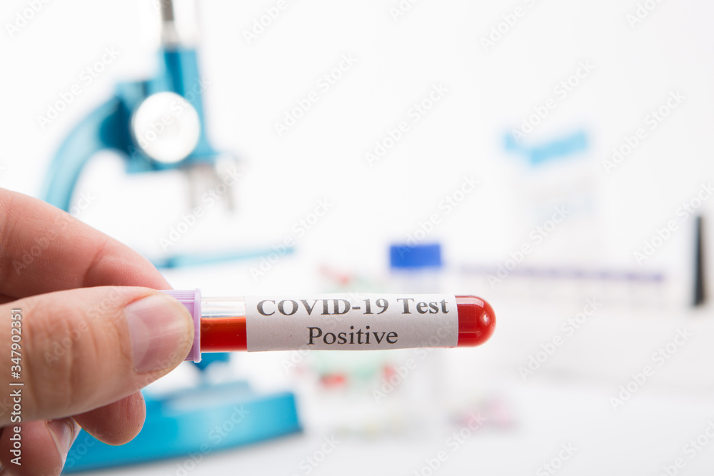Fototapeta premium Test tube with a positive COVID-19 test on a white background