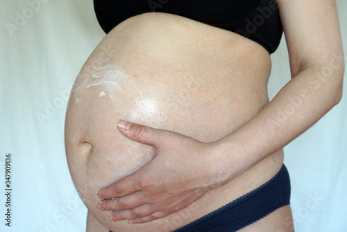 pregnant woman rubs her stomach with moisturizer for stretch marks