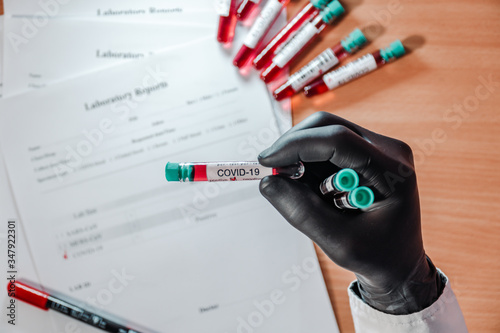 The doctor holds medical test tubes with blood tests for coronavirus in his black-gloved hand. Near are the laboratory results of tests and tubes with blood tests.