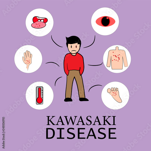 Illustration vector: kawasaki disease symptom, health and medical infographic