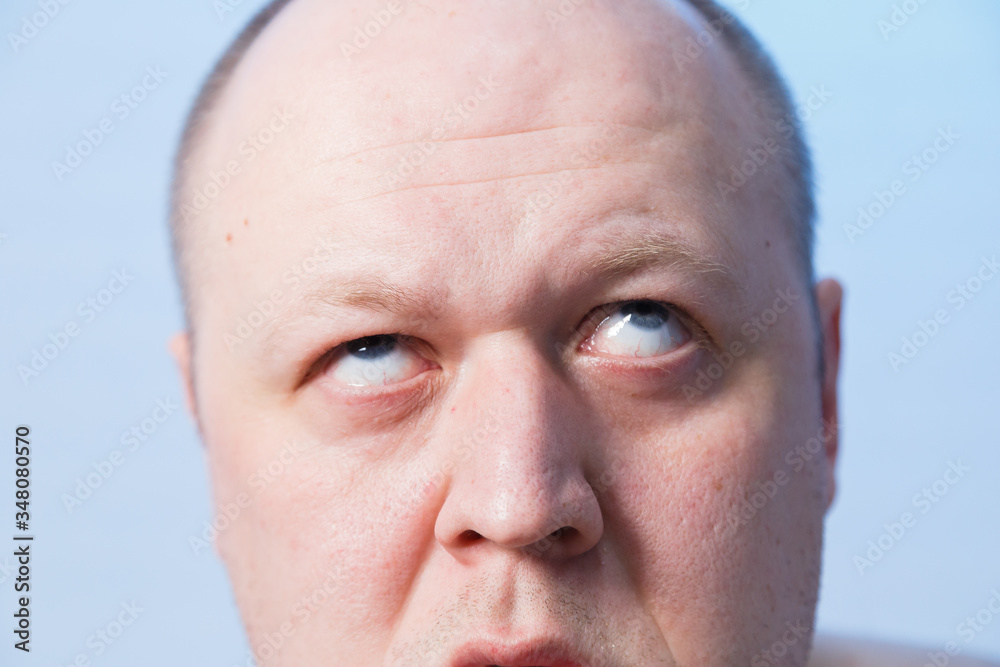Obraz premium Portrait of a bald man who bulged his eyes.