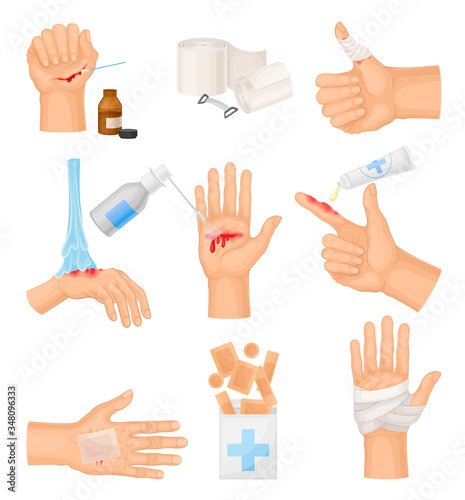 Hands with Injured Skin and Procedures of Bandaging and Wound Cleaning Vector Set