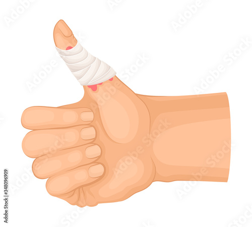 Bandaged Thumb Finger Because of Injury or Wound Vector Illustration