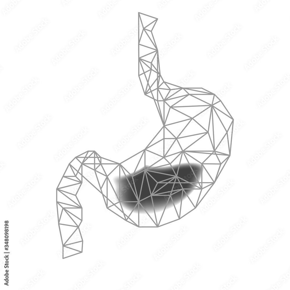 Healthy Human Stomach with acid digestive. Low poly wireframe style ...