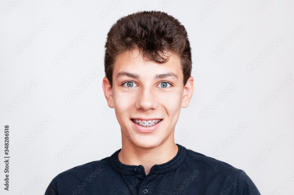 Braces on the teeth of a young boy who sincerely smiles and is happy that soon he will have beautiful, aligned teeth Braces on the teeth of a young boy who sincerely smiles and is happy that soon he will have beautiful, aligned teeth
