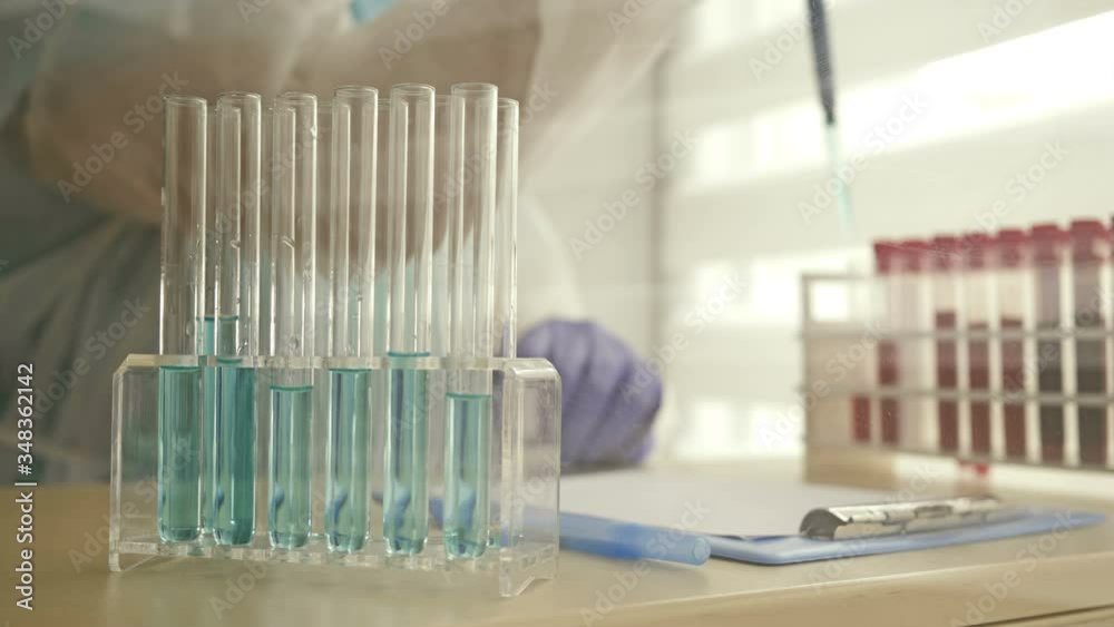 The laboratory assistant records the results after a blood test for Coronavirus Disease 2019 (COVID-19). Medical blurred background. The laboratory assistant records the results after a blood test for Coronavirus Disease 2019 (COVID-19). Medical blurred background.