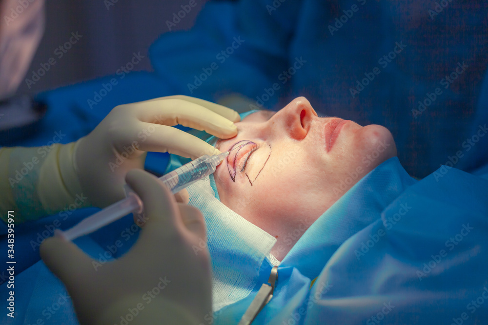 Naklejka premium Surgeon inserts an injection into the upper eyelid of the patient before performing the eyelid lift operation. Blepharoplasty