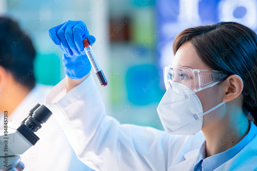 blood test result concept
