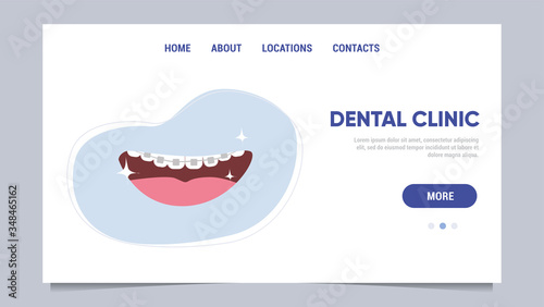 Teeth with braces. Smiling mouth. Consultation with orthodontist. Orthodontic services. Template for dental clinic website, landing page Vector illustration in flat style.