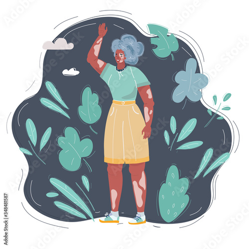 Illustration of pretty young woman vitiligo affected pigmentation